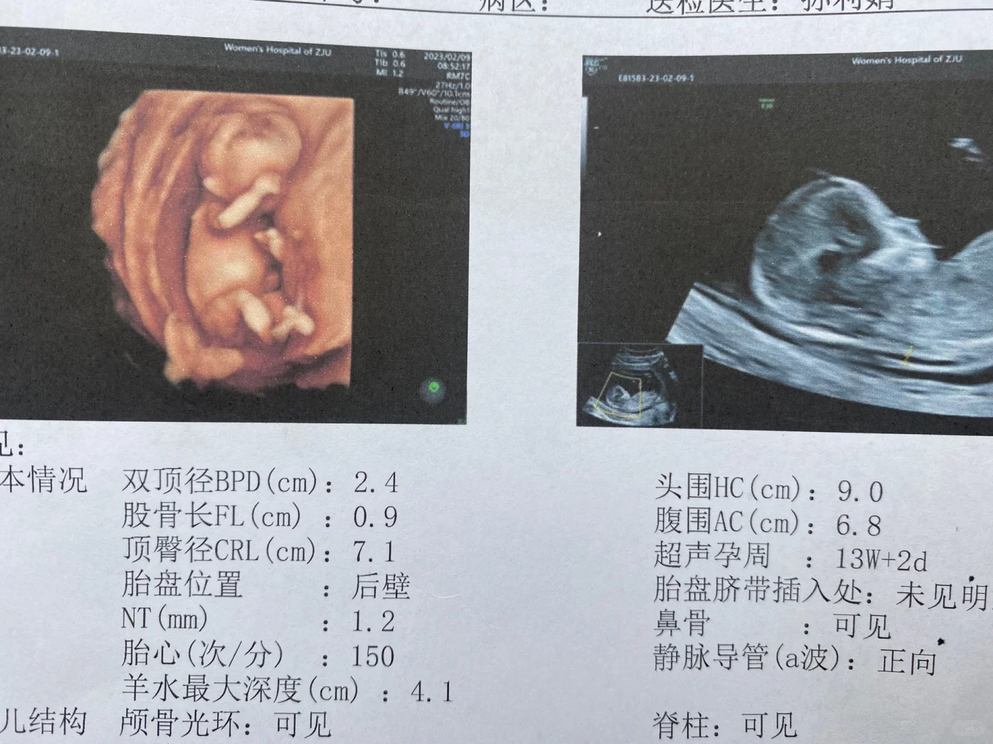 Nt秒过，一切正常,正规三代代生机构&国内最好的供卵医院
