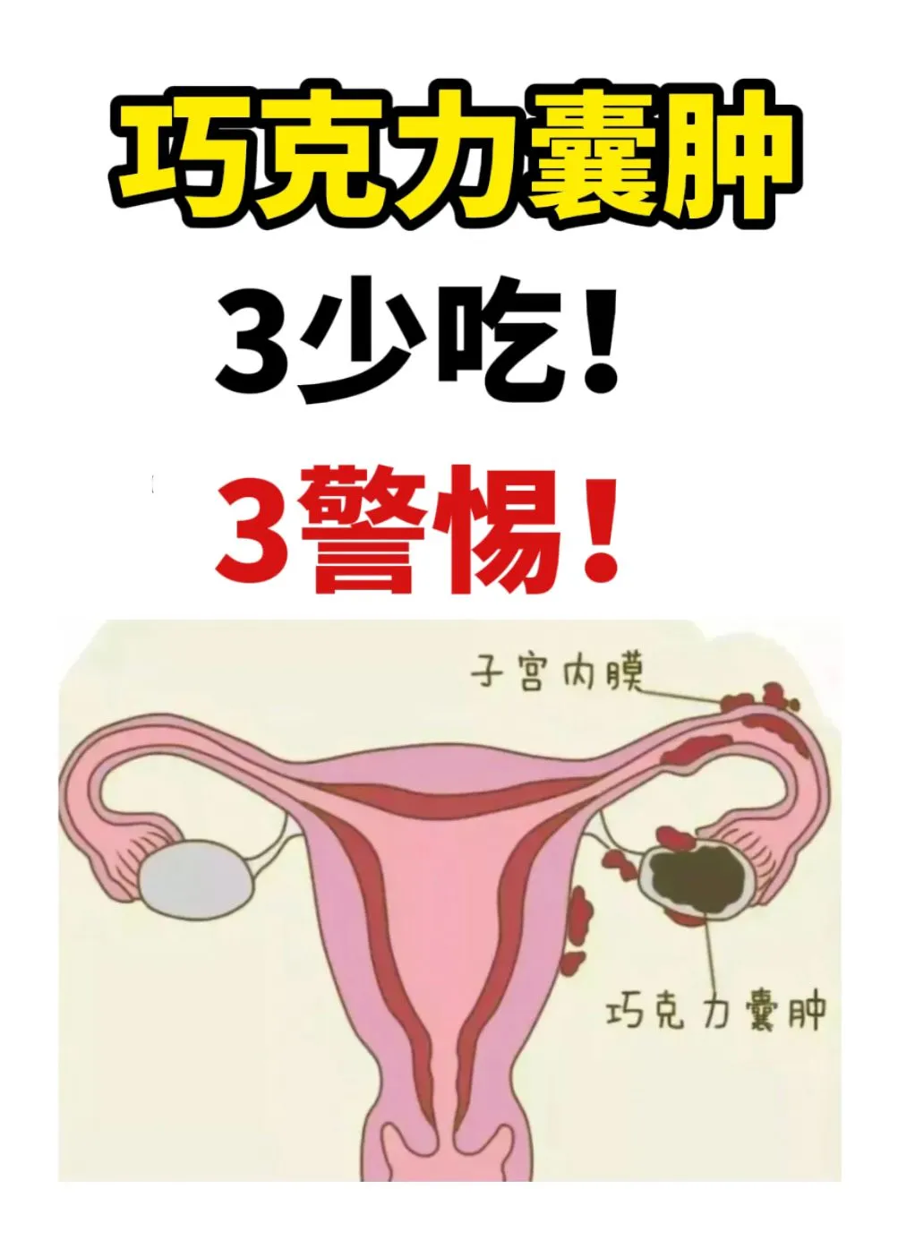 巧克力囊肿，3少吃，3警惕！,代孕哪家口碑好